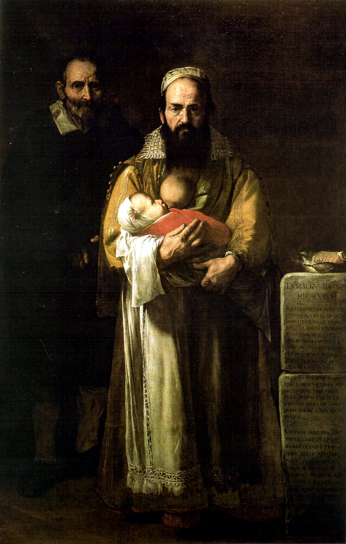 the bearded woman